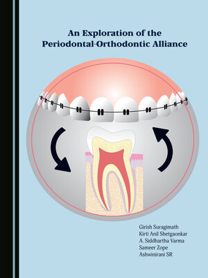 cover image of An Exploration of the Periodontal-Orthodontic Alliance